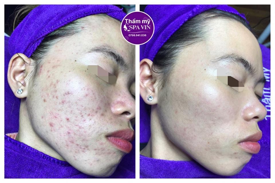Top 8 spa chăm sóc sắc đẹp uy tín và chất lượng tại TP. Đà Lạt