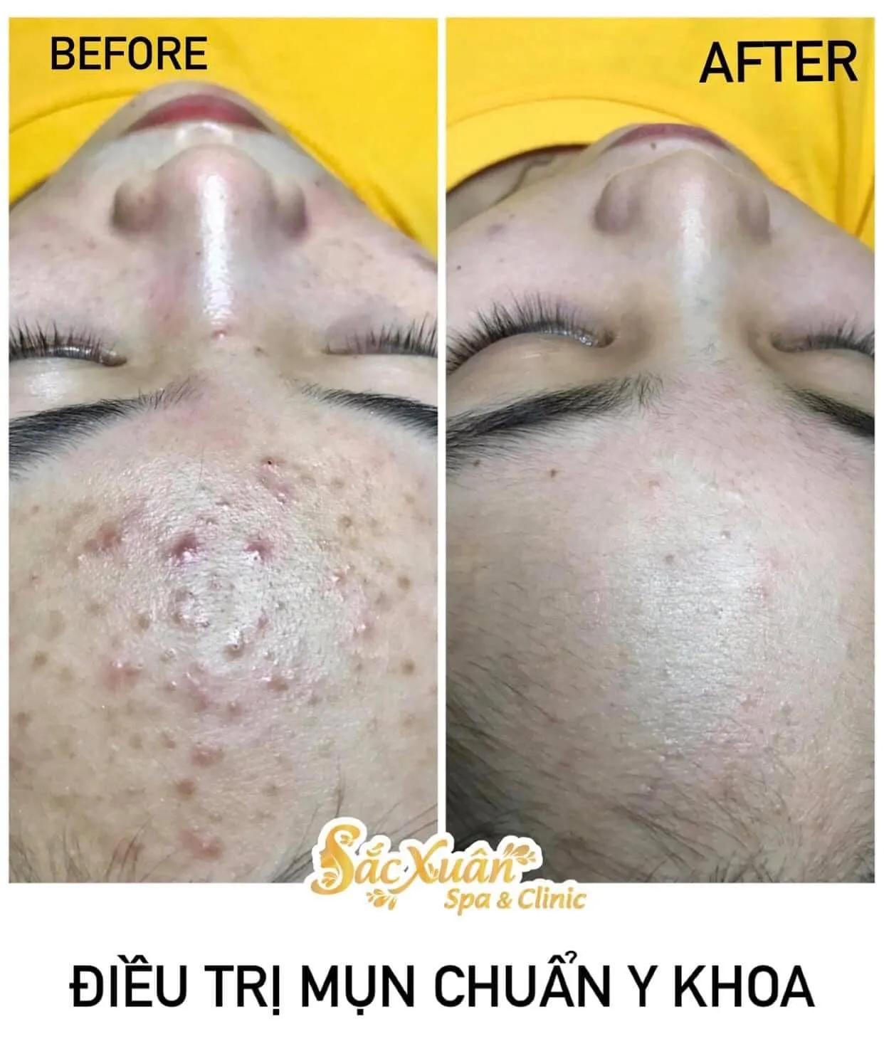 Top 8 Spa làm đẹp uy tín và chất lượng nhất tại TP. Bến Tre