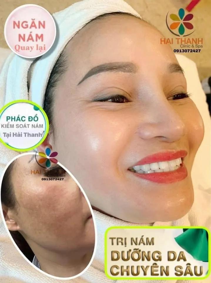 Top 10 địa chỉ Spa chăm sóc sắc đẹp đáng tin cậy nhất tại Tuyên Quang