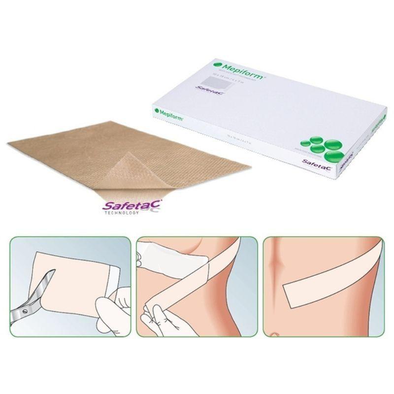 Top 7 miếng dán trị sẹo hiệu quả nhất hiện nay
