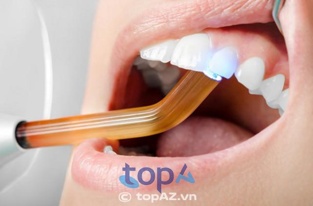 5 địa chỉ trám răng thẩm mỹ uy tín nhất Đà Lạt – Chất lượng đã được kiểm chứng