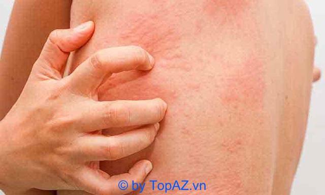 Top 10 địa chỉ xét nghiệm ký sinh trùng uy tín tại TPHCM