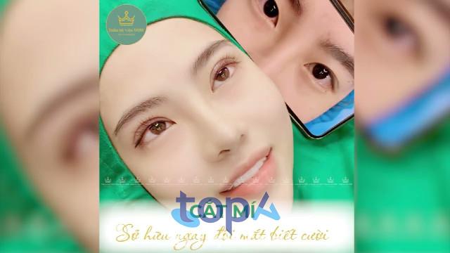 Top 5 địa chỉ cắt mí mắt uy tín tại Buôn Ma Thuột – An toàn, chất lượng đáng tin cậy