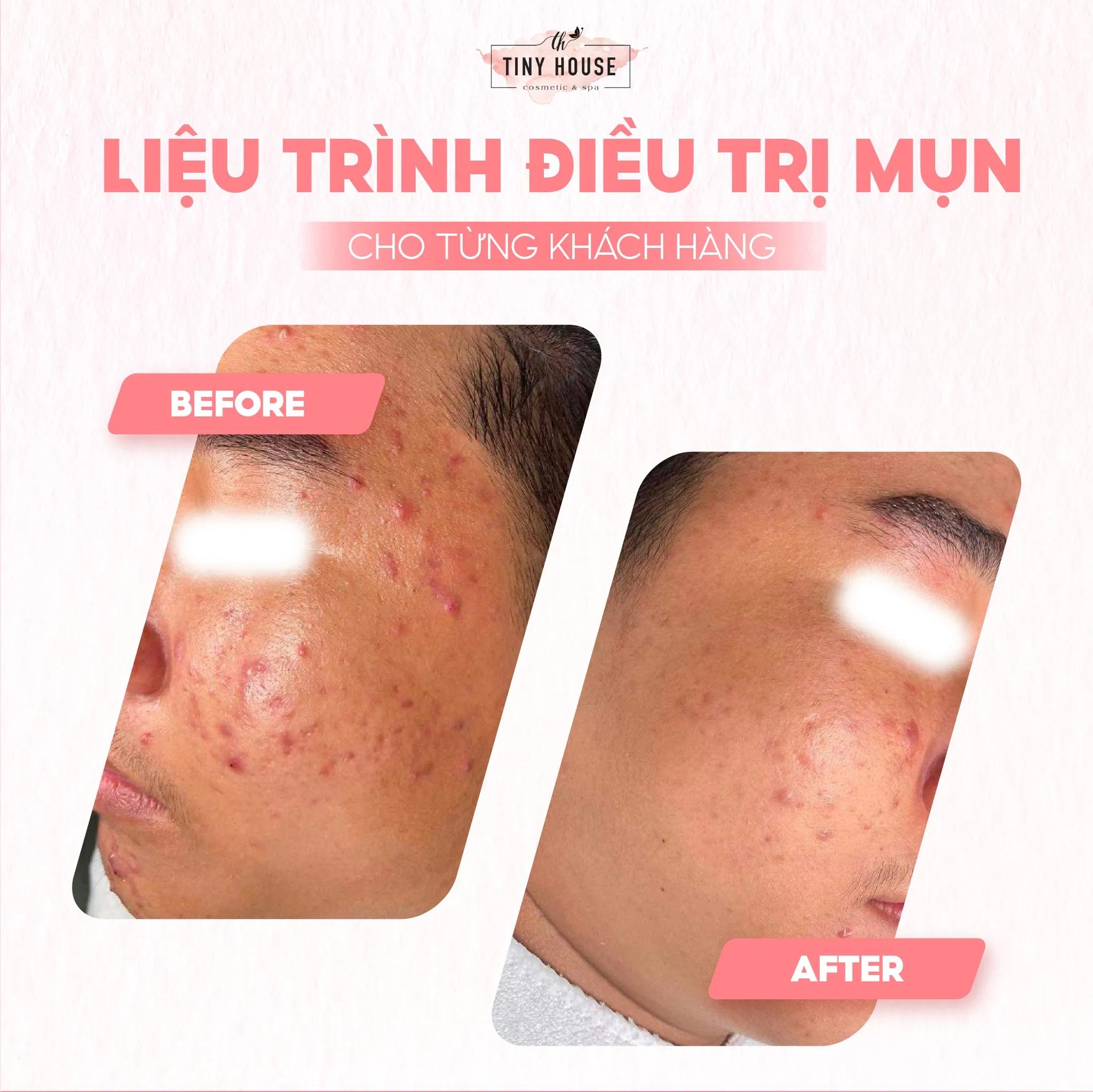 8 Spa làm đẹp đáng trải nghiệm nhất tại Tây Ninh - Chất lượng vượt trội, dịch vụ hoàn hảo