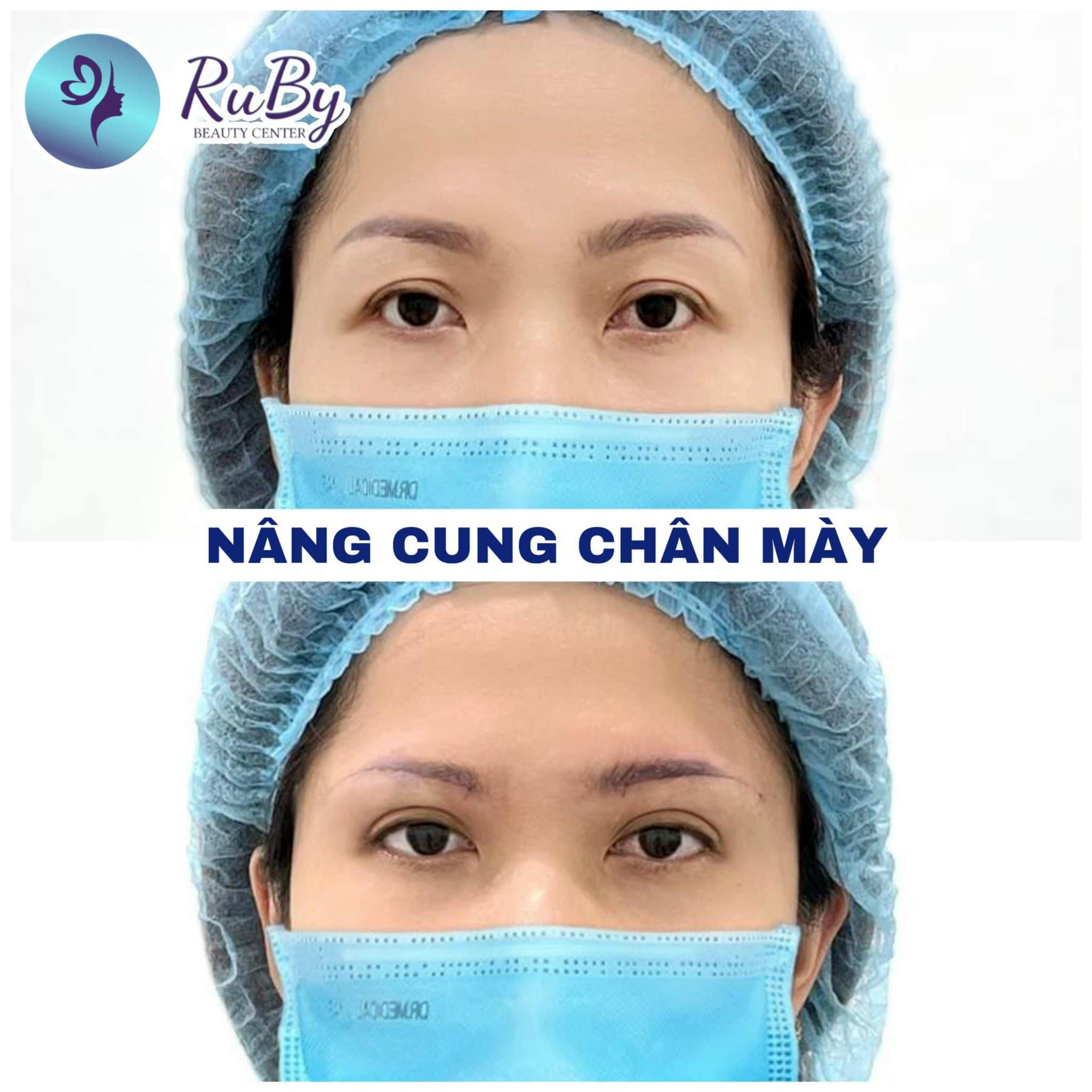 Top 5 địa chỉ thẩm mỹ uy tín nhất tại thành phố biển Quy Nhơn, Bình Định