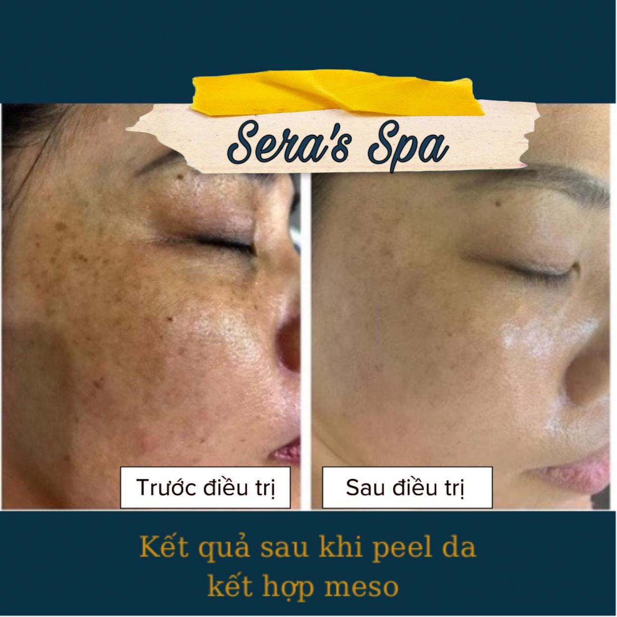 Top 10 địa chỉ Spa làm đẹp đáng trải nghiệm nhất tại Nha Trang, Khánh Hòa – Nơi hội tụ tinh hoa chăm sóc sắc đẹp