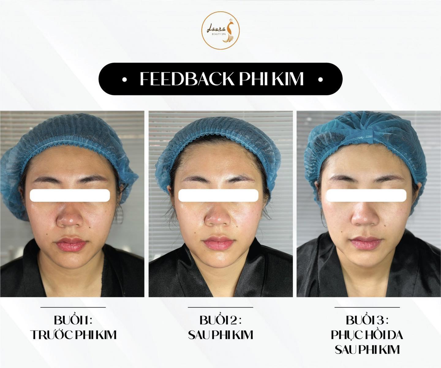 Danh sách 8 Spa làm đẹp uy tín và chất lượng nhất tại quận Cầu Giấy, Hà Nội