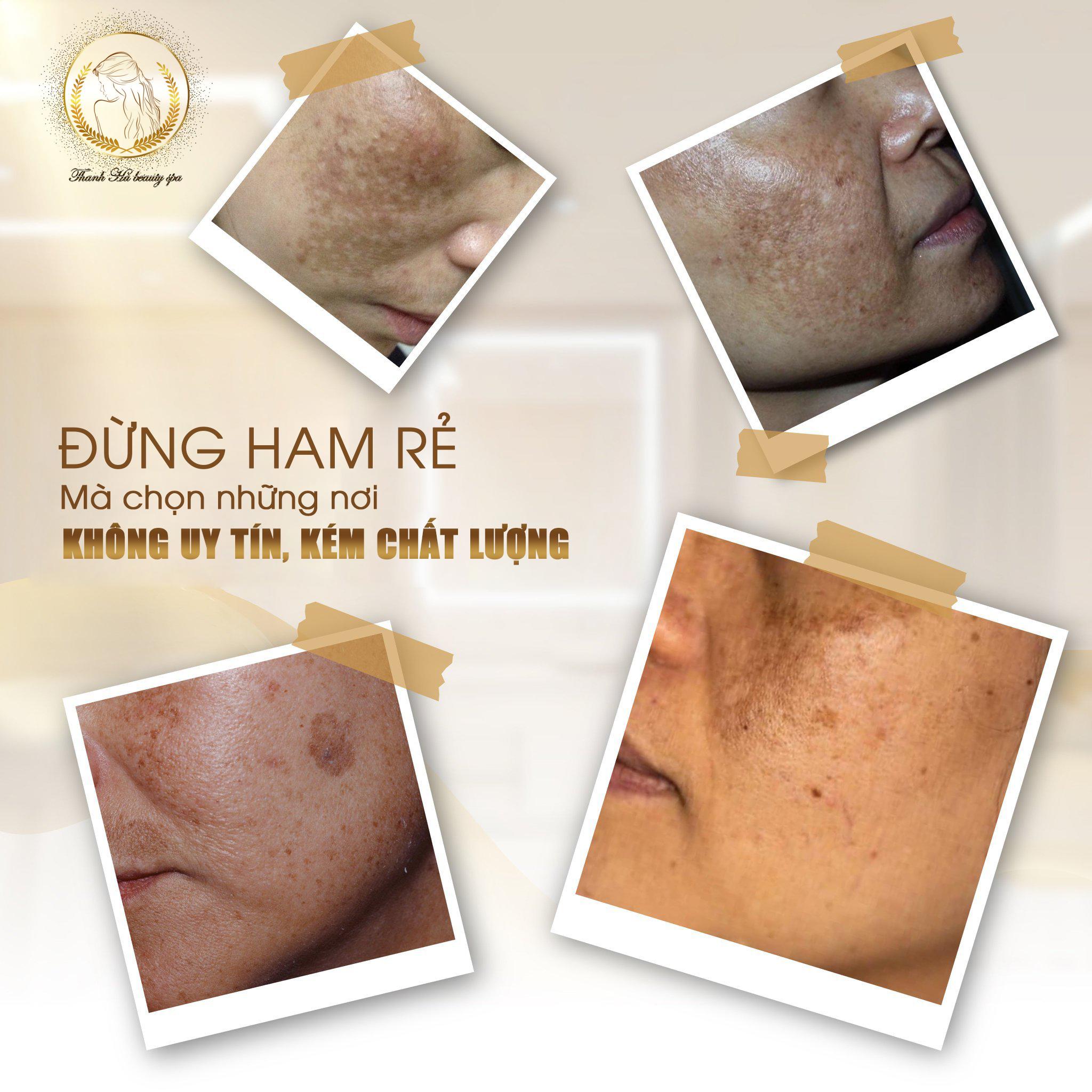 10 Địa chỉ Spa làm đẹp đáng trải nghiệm nhất Vĩnh Phúc