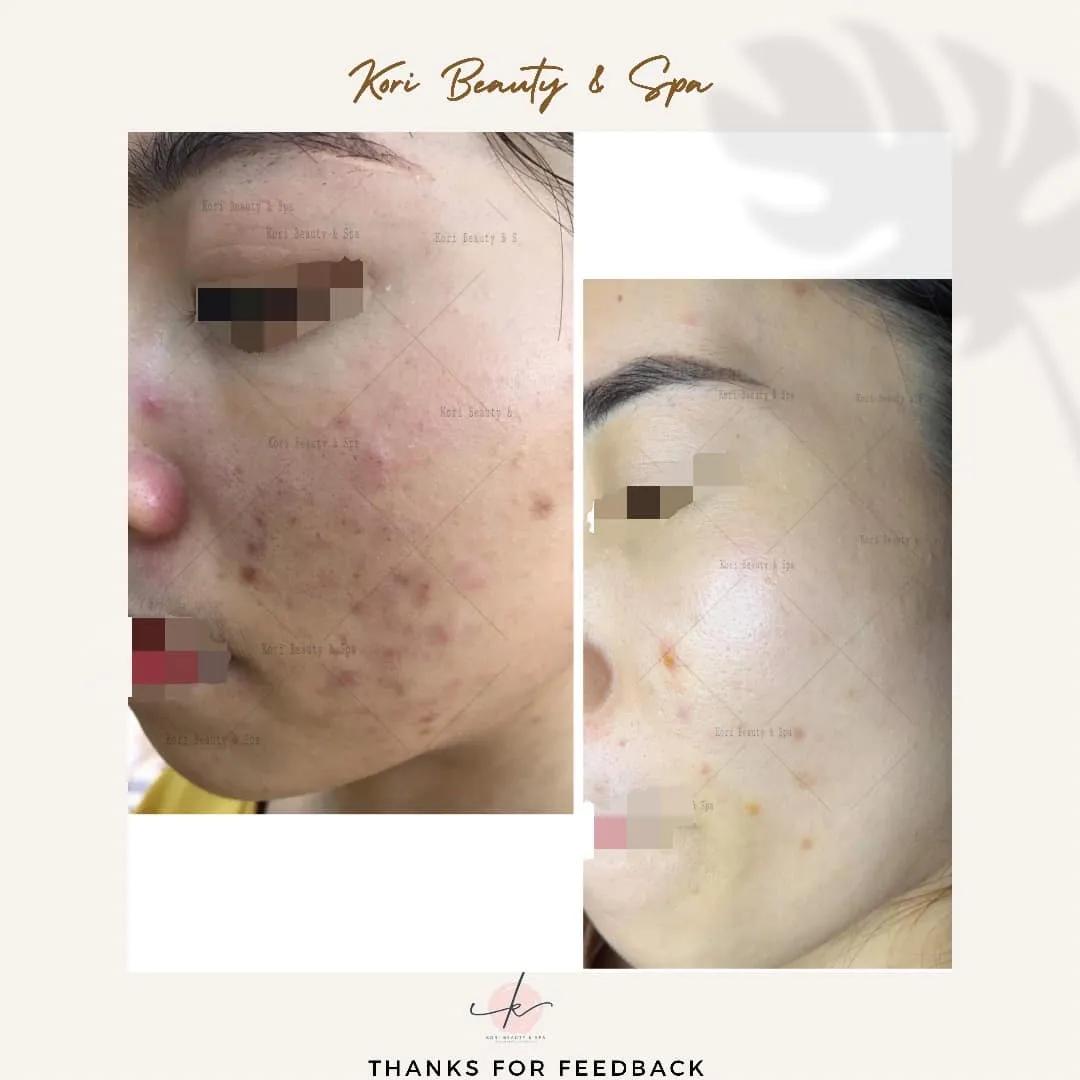 Top 10 địa chỉ Spa làm đẹp đáng trải nghiệm nhất tại Sóc Sơn, Hà Nội