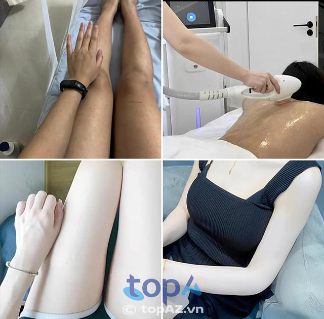 Top 5 địa chỉ trị thâm đầu gối uy tín và hiệu quả tại TPHCM