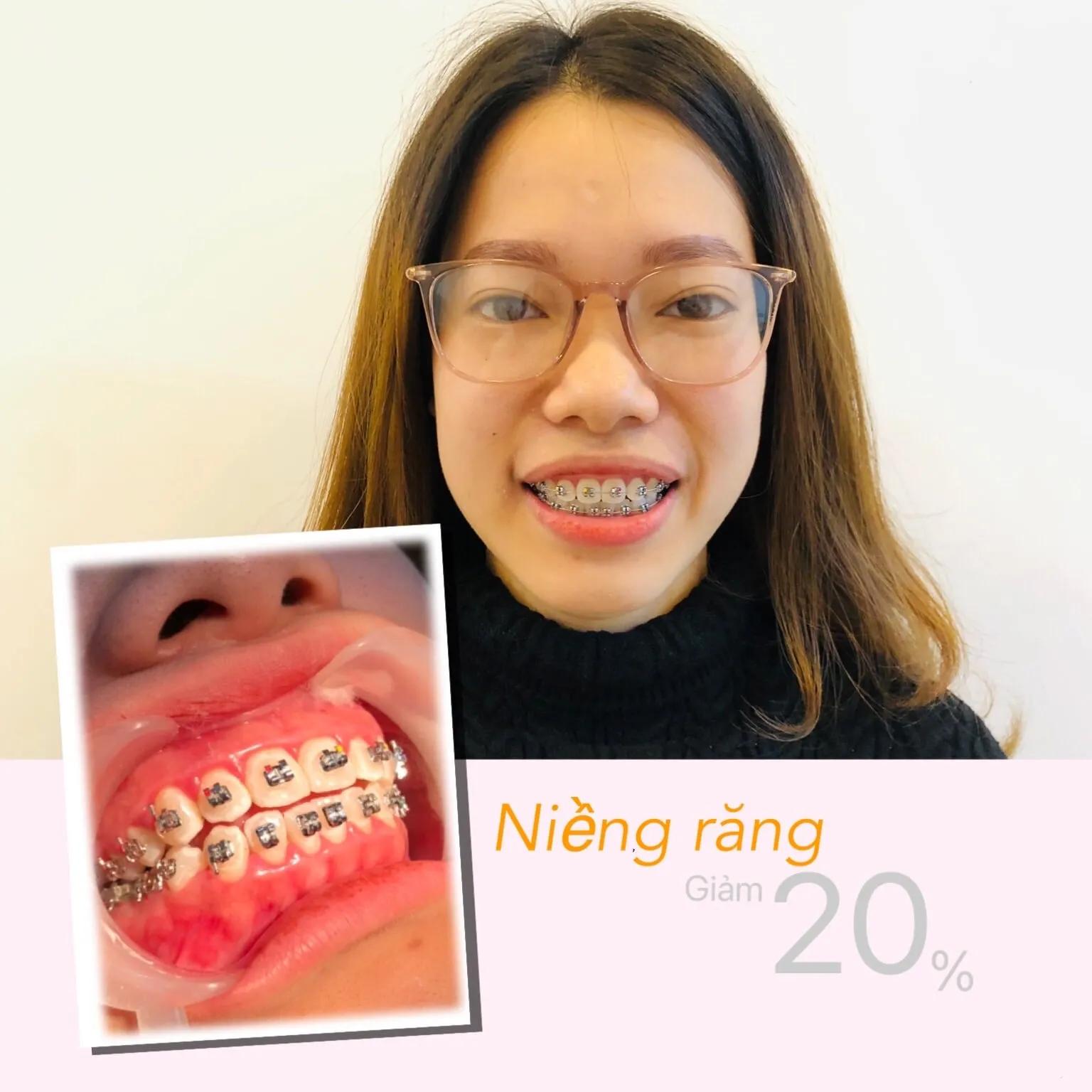 Top 8 địa chỉ phòng khám nha khoa đáng tin cậy hàng đầu tại Quận 3, TP HCM