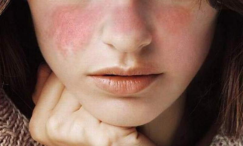 7 Công dụng nổi bật và điểm cần lưu tâm khi dùng Tofisopam