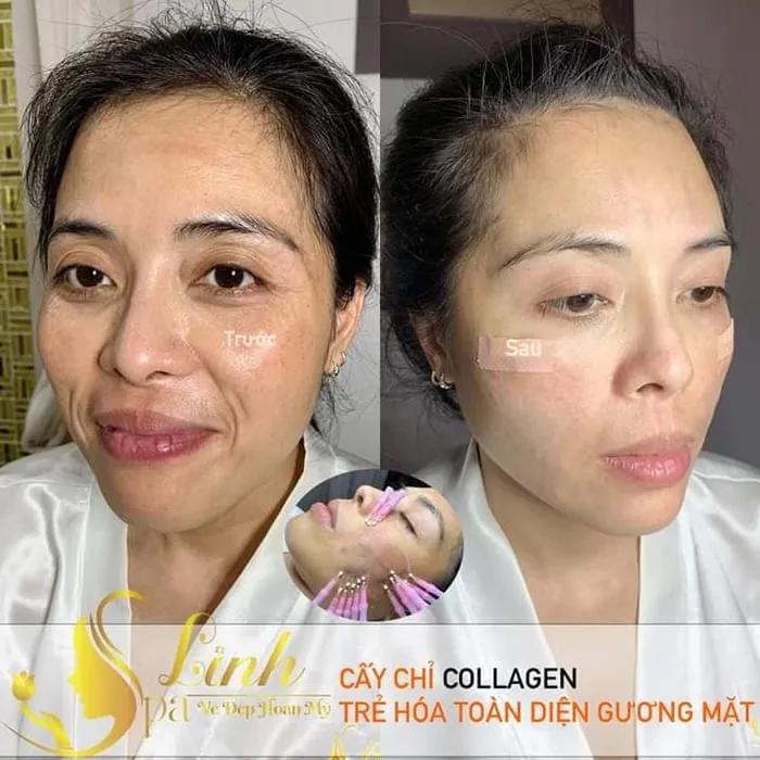 5 Địa chỉ Spa chăm sóc da mặt hàng đầu Quận 6, TP.HCM - Trải nghiệm làm đẹp đáng tin cậy