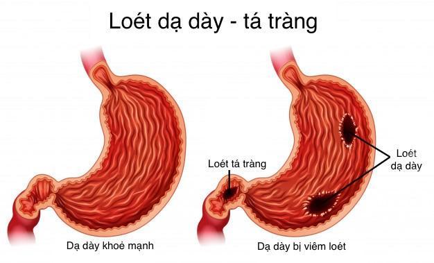 6 Công dụng nổi bật và điểm cần lưu tâm khi sử dụng Oracortia