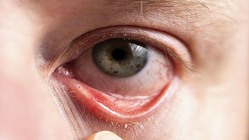 8 Công dụng nổi bật và điểm cần lưu ý khi dùng Histalyn
