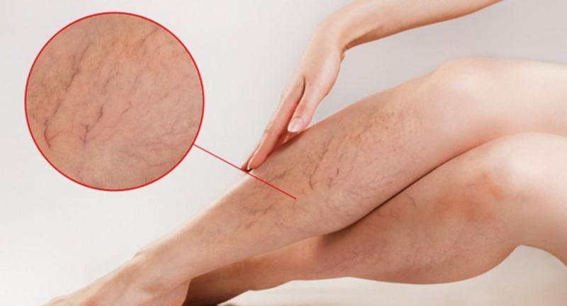 Khám Phá 8 Công Dụng và Những Lưu Ý Quan Trọng Khi Sử Dụng Bidisol