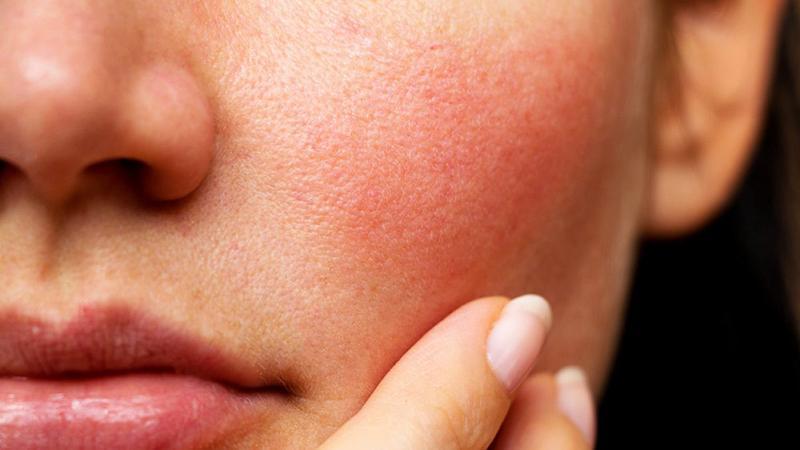 Khám phá 6 lợi ích và điều cần lưu ý khi sử dụng Sihiron hiệu quả