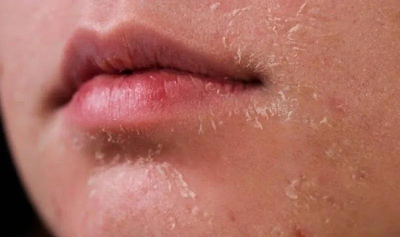 5 Công Dụng Nổi Bật Và Những Lưu Ý Quan Trọng Khi Sử Dụng Anbesol