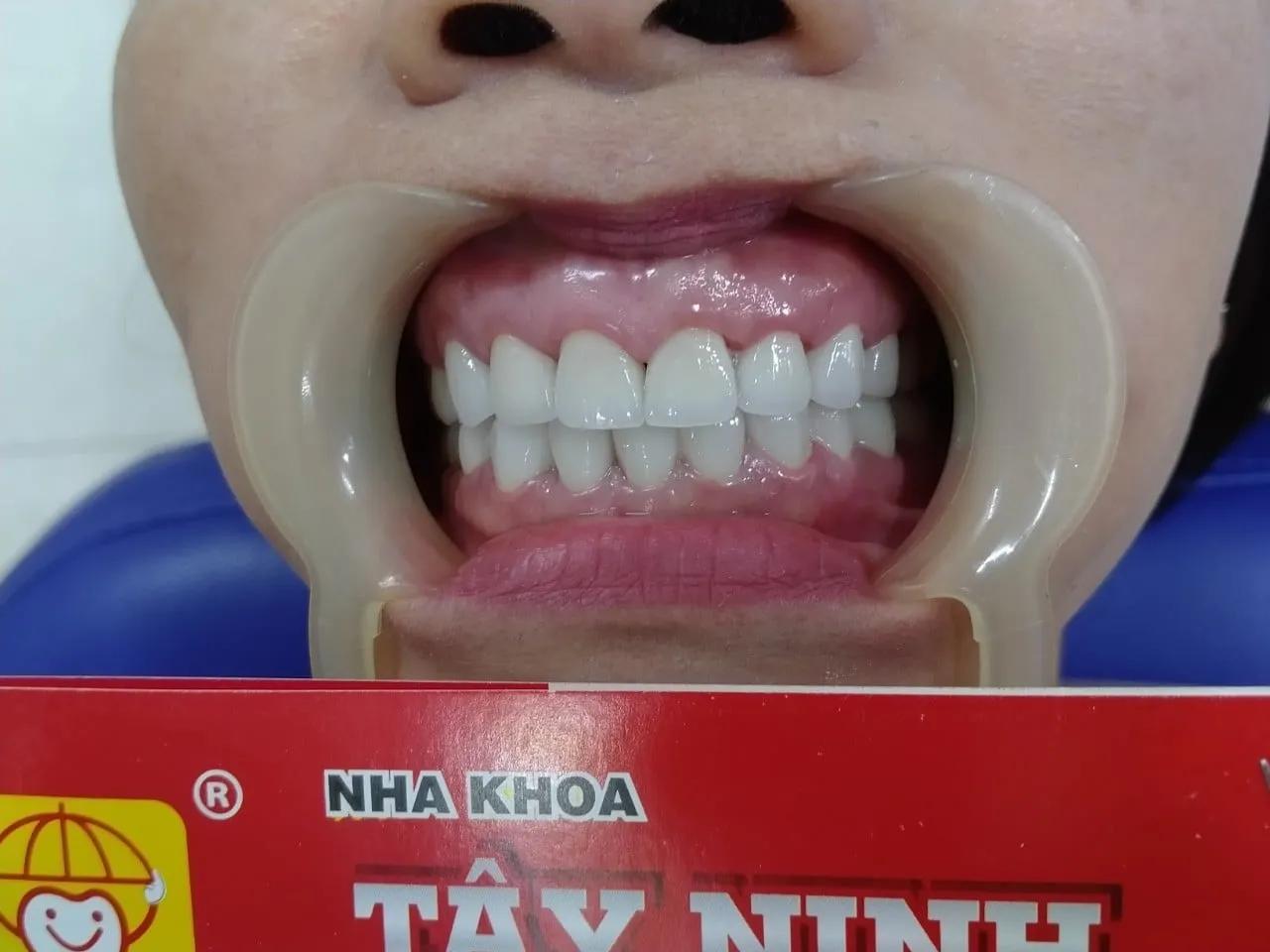 Top 11 Địa chỉ phòng khám nha khoa chất lượng và đáng tin cậy nhất tại Tây Ninh