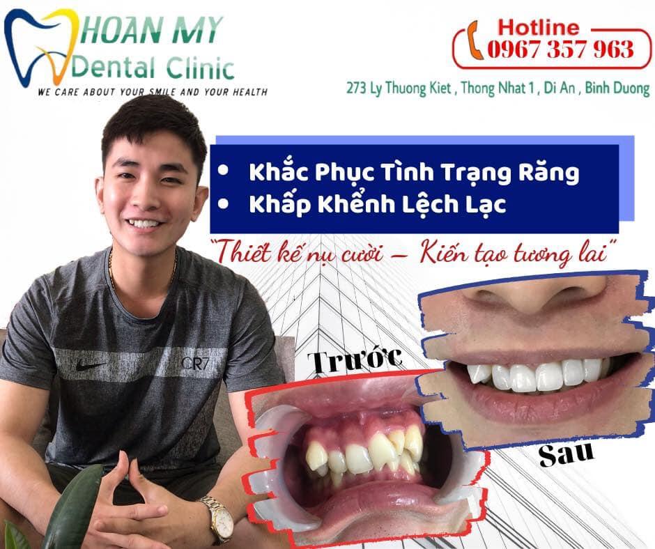 Top 5 địa chỉ phòng khám nha khoa chất lượng nhất tại Dĩ An, Bình Dương