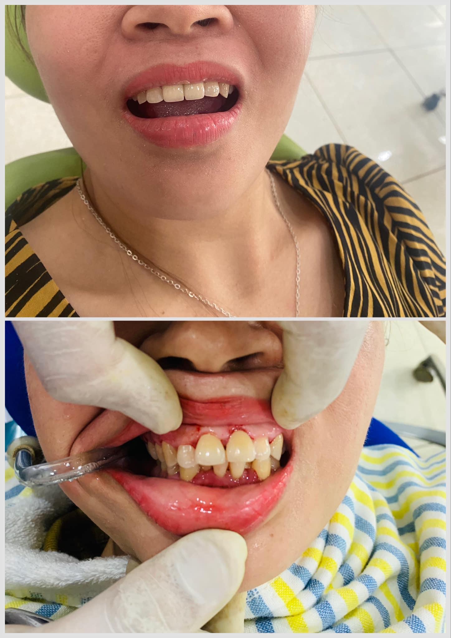 Top 5 địa chỉ nha khoa đáng tin cậy nhất tại Quốc Oai, Hà Nội