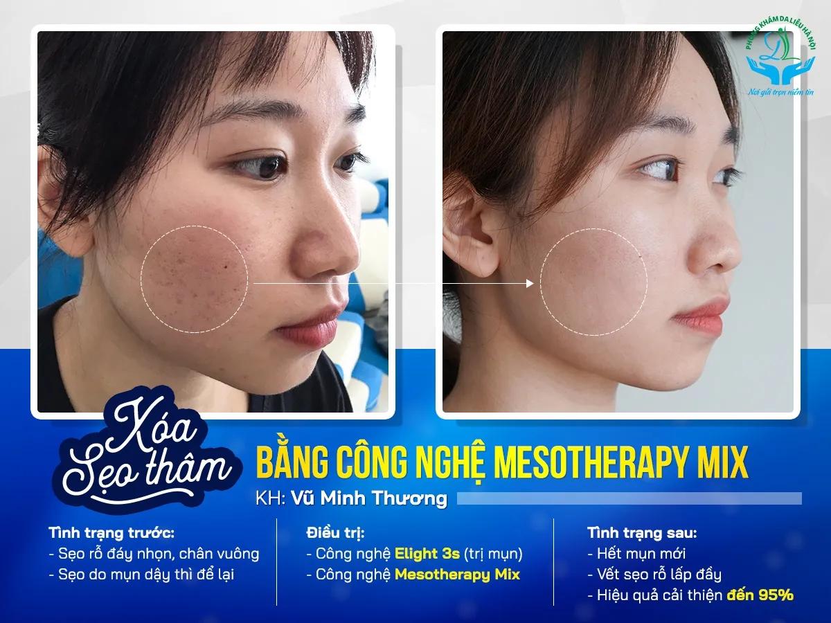 7 Địa chỉ phòng khám da liễu chất lượng hàng đầu Hà Nội