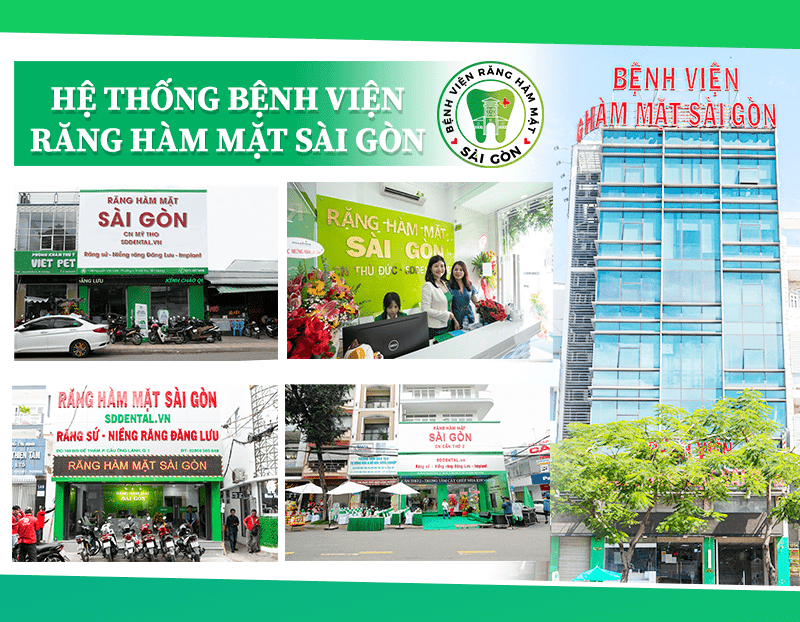 Top 7 bệnh viện răng hàm mặt đáng tin cậy tại Việt Nam