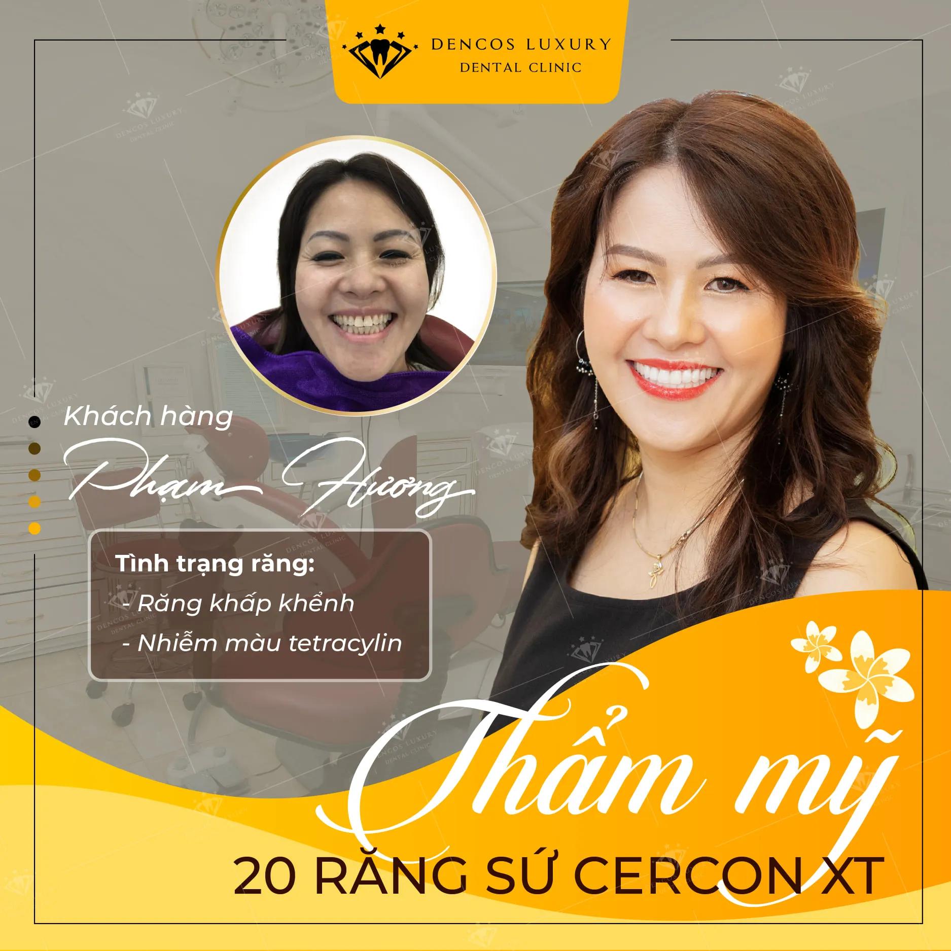 Khám phá 10 địa chỉ bọc răng sứ chất lượng và uy tín bậc nhất tại Hà Nội