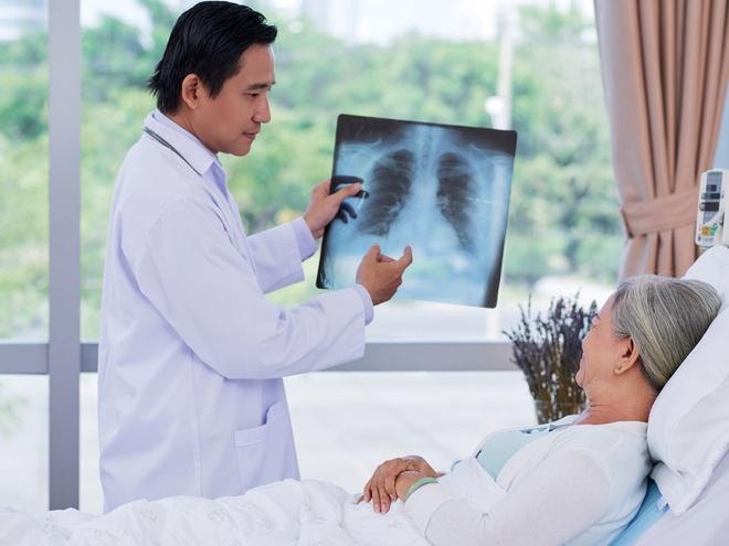 9 Điều cần đặc biệt lưu ý về bệnh viêm màng phổi