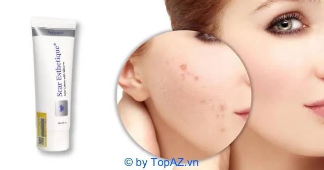 Kem Trị Sẹo Scar Esthetique có thực sự hiệu quả? Giá thành sản phẩm là bao nhiêu?