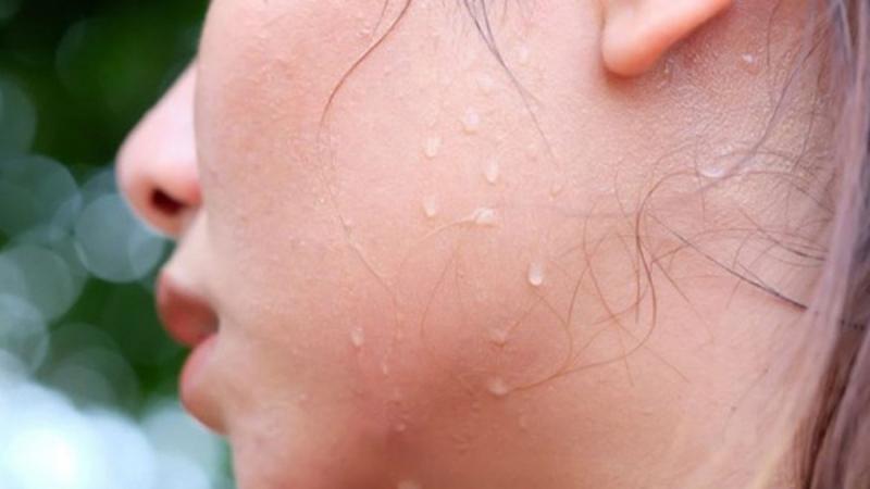 8 Công dụng đáng chú ý và những điều cần lưu tâm khi dùng Dorocodon