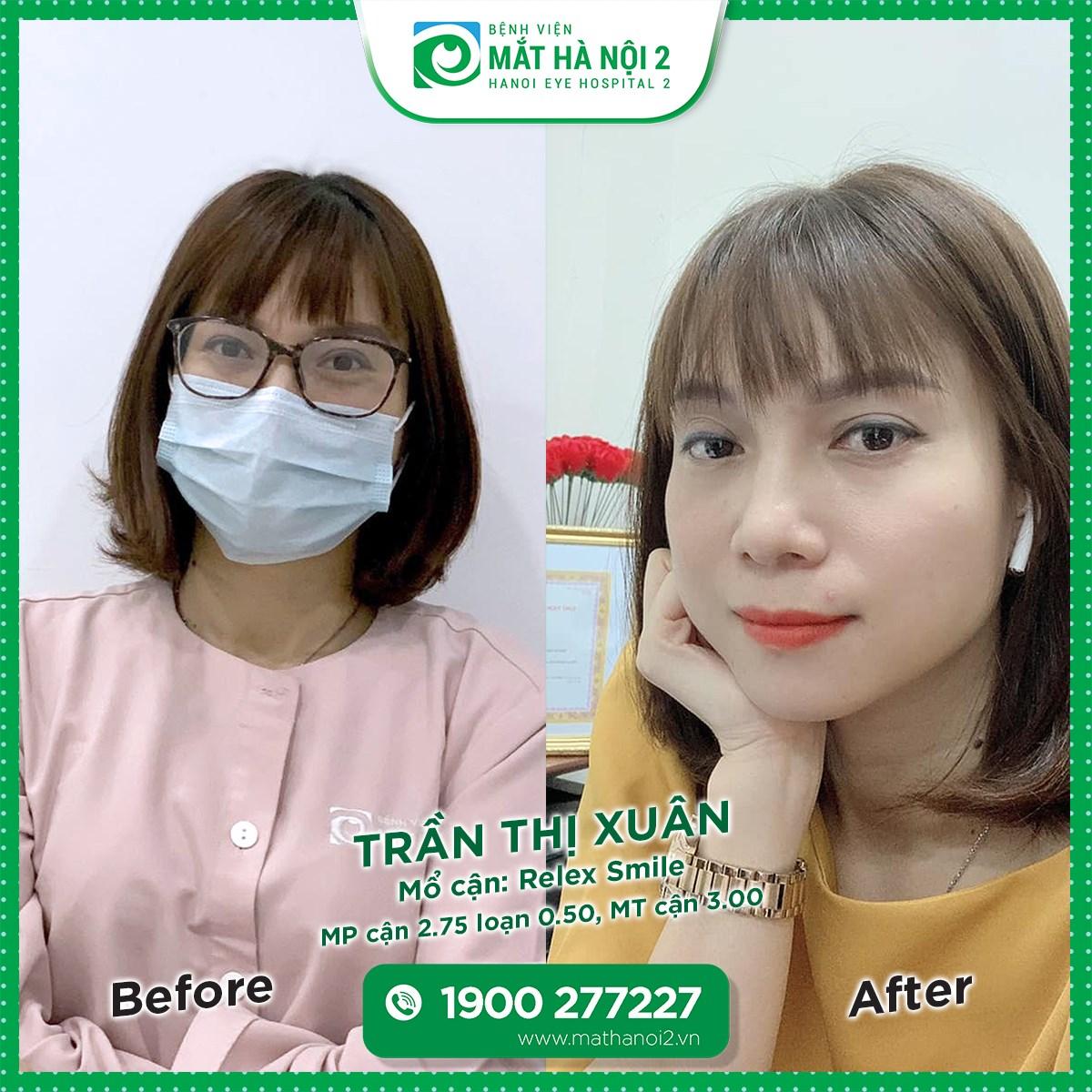 Danh sách 10 Bệnh viện Mắt uy tín và chất lượng nhất Thủ đô Hà Nội
