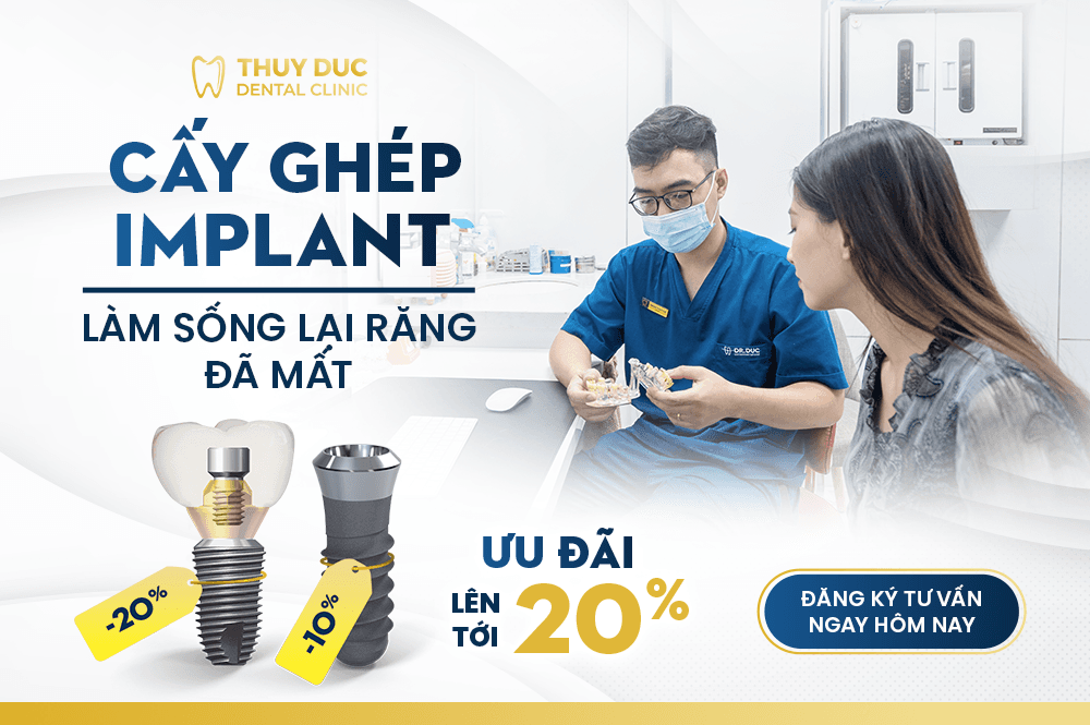 Top 8 địa chỉ cấy ghép răng implant uy tín tại quận Đống Đa, Hà Nội
