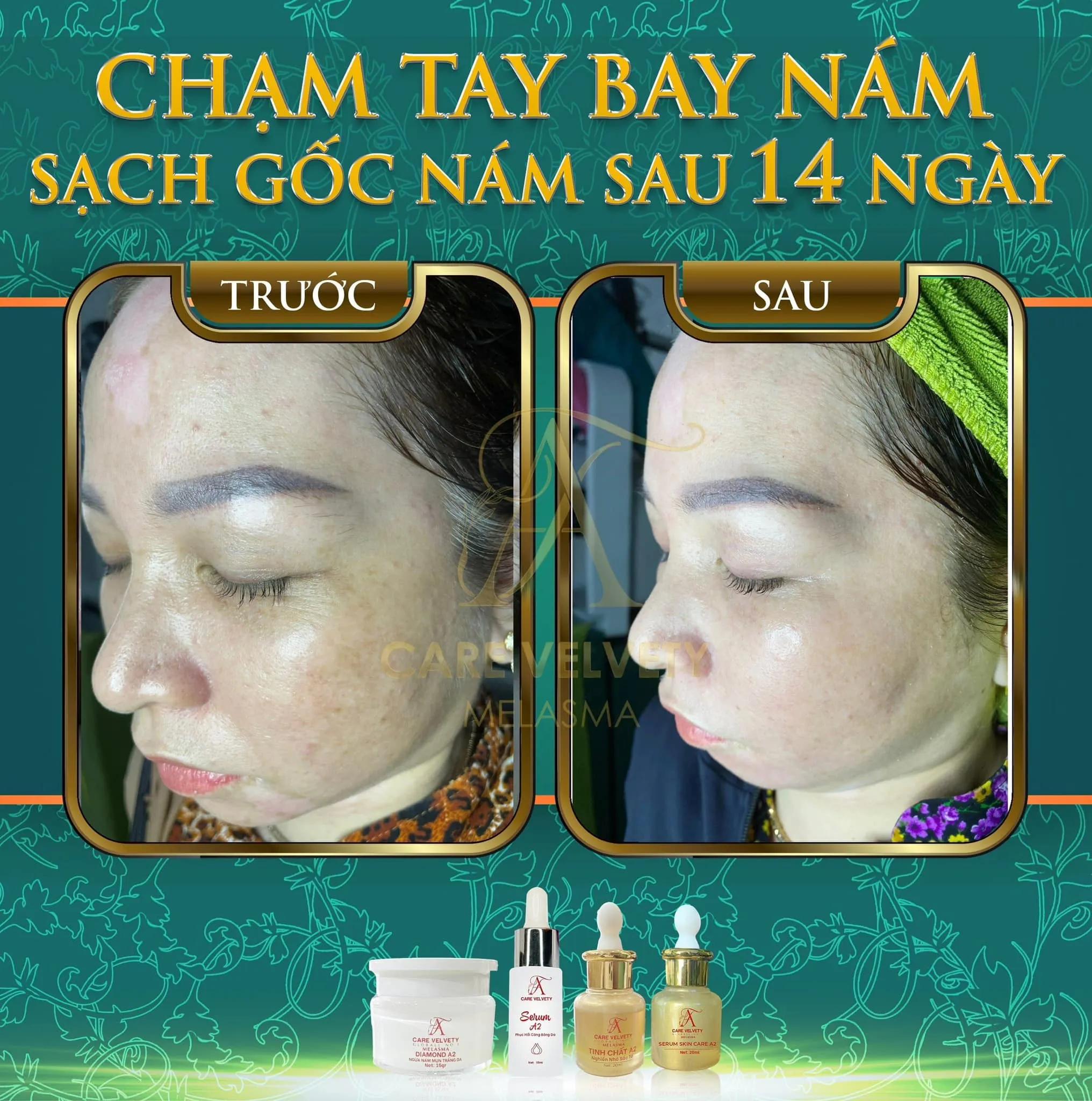 Top 4 địa chỉ spa chăm sóc sắc đẹp đáng trải nghiệm tại Tp. Vị Thanh, Hậu Giang