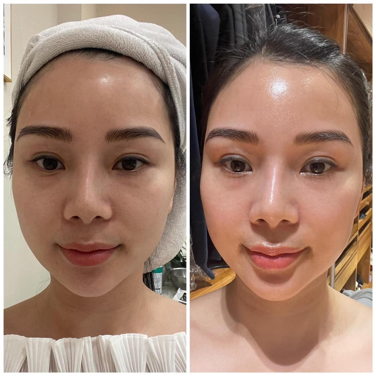 Top 6 Spa Làm Đẹp Uy Tín và Chất Lượng Nhất tại Thành Phố Rạch Giá, Kiên Giang