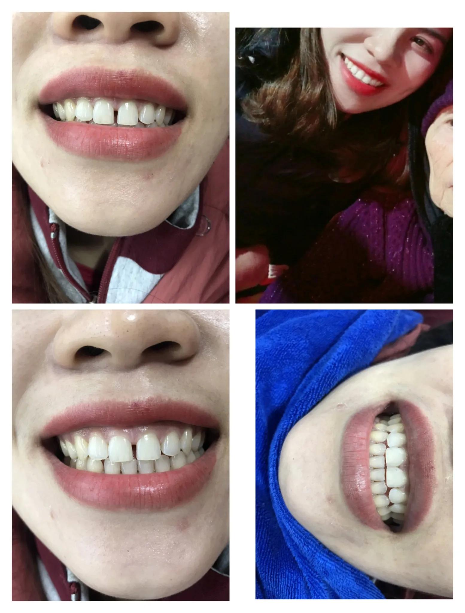 Top 4 Phòng Khám Nha Khoa Uy Tín Nhất Tại Hà Giang