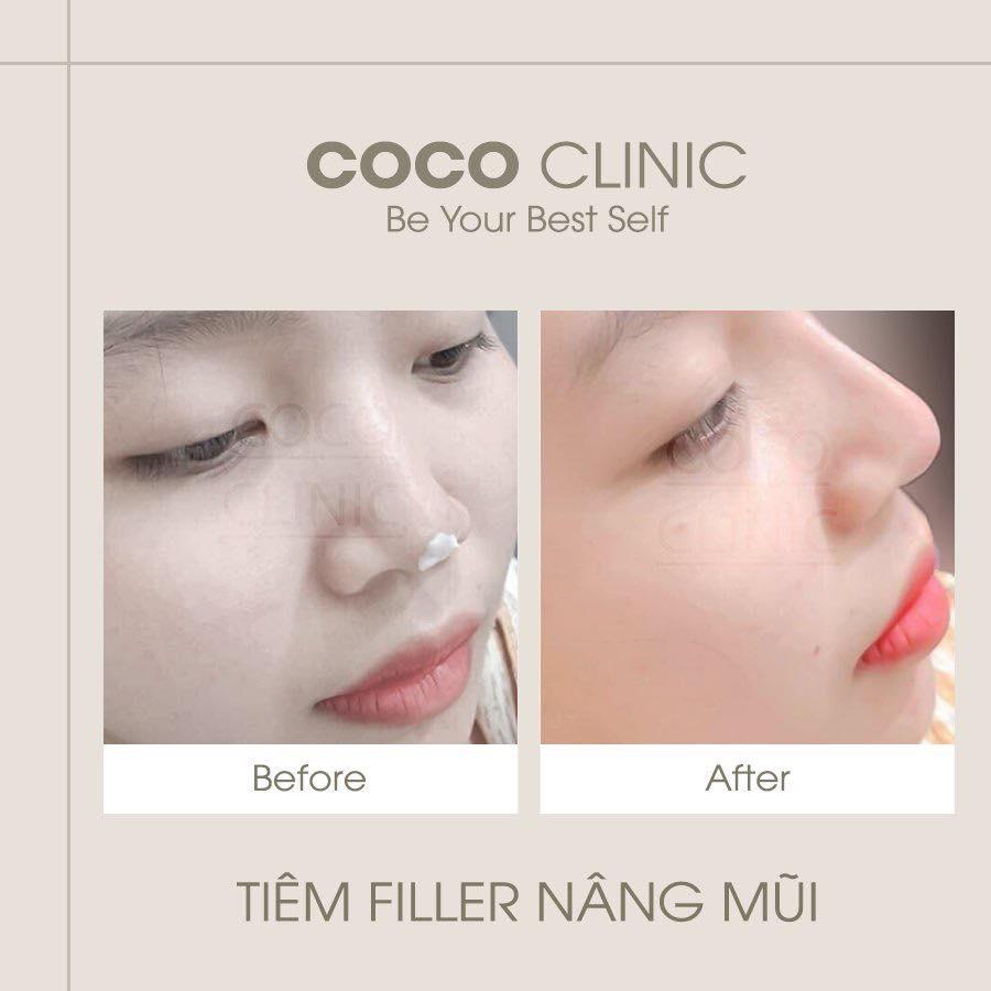Top 6 địa chỉ tiêm filler - botox đáng tin cậy và chất lượng hàng đầu tại quận 7, TP.HCM