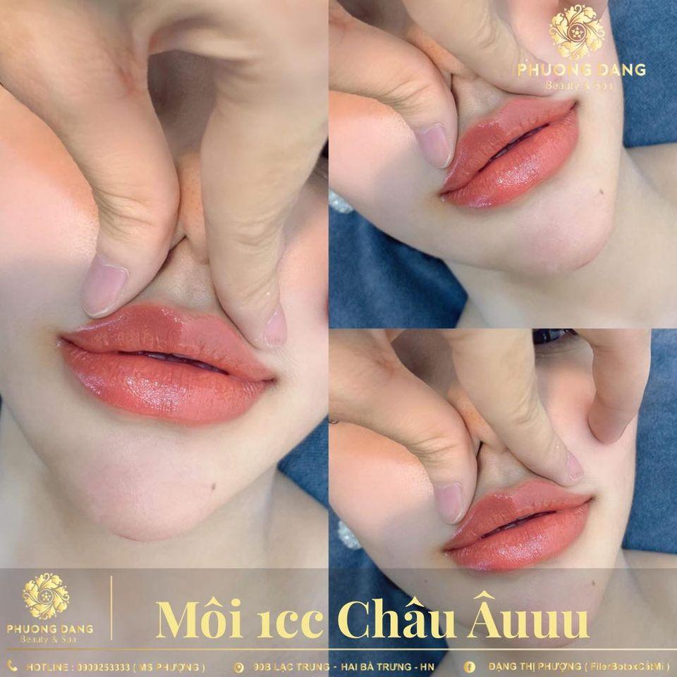 7 Địa chỉ tiêm filler, botox đáng tin cậy và chất lượng hàng đầu tại Hà Nội