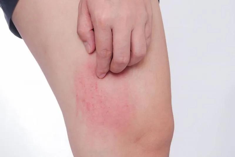Meyernota: 7 lợi ích nổi bật và hướng dẫn sử dụng an toàn