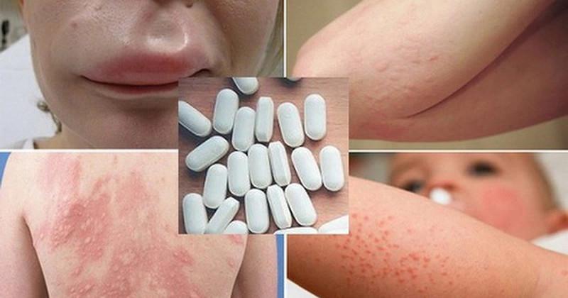 Top 7 Công Dụng và Lưu Ý Khi Sử Dụng Gliclada 60mg