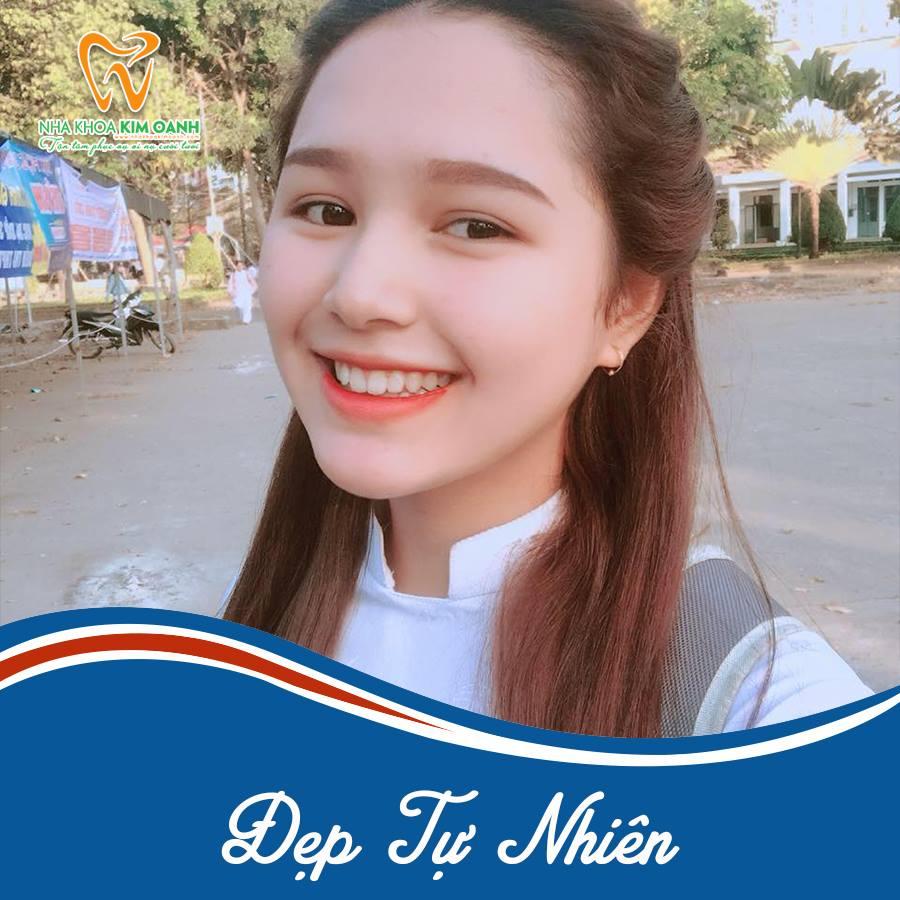 Top 6 địa chỉ tẩy trắng răng đáng tin cậy và chất lượng nhất tại quận Cầu Giấy, Hà Nội