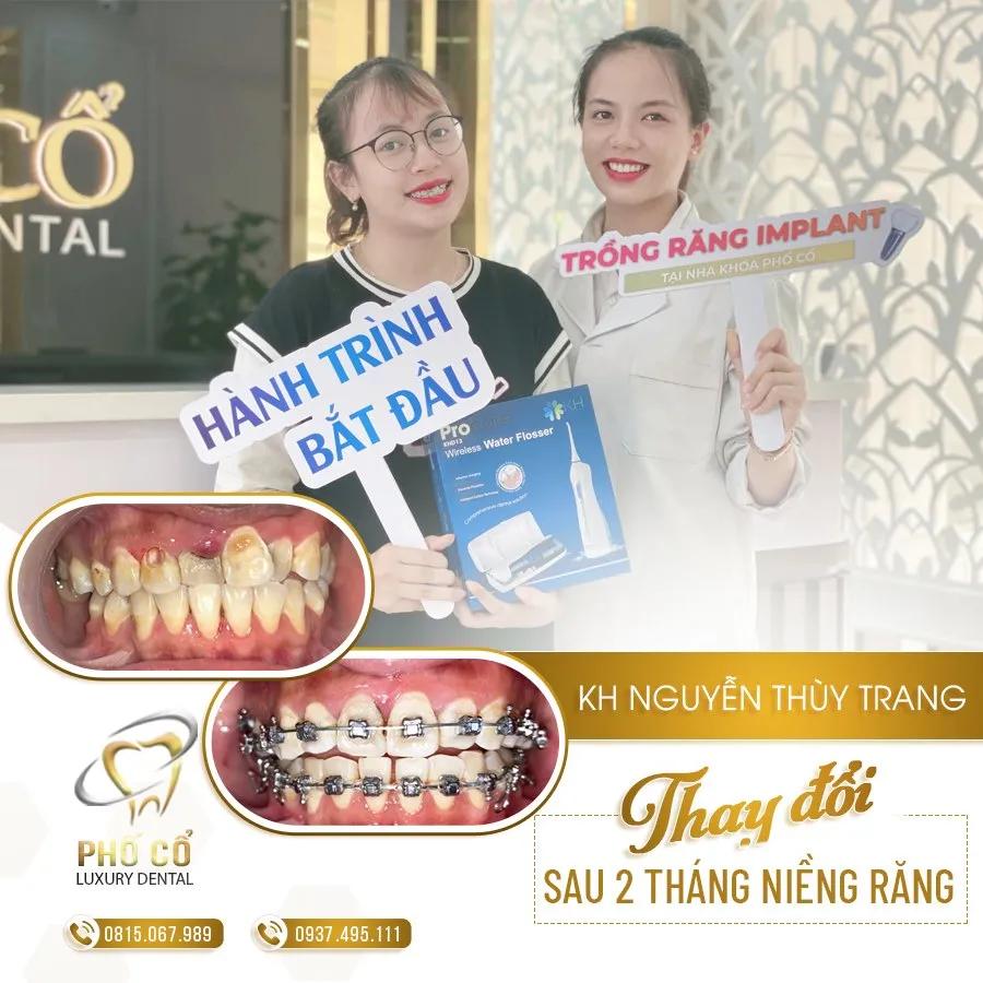 7 địa chỉ nha khoa chất lượng nhất quận Ngô Quyền, Hải Phòng