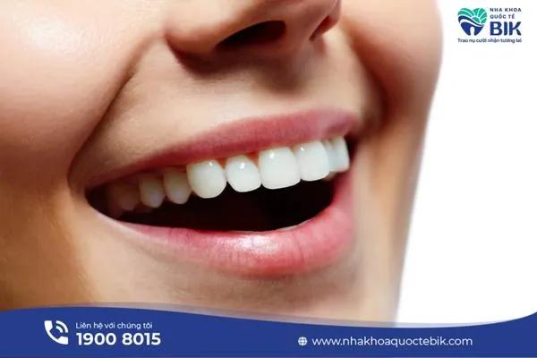Top 10 địa chỉ bọc răng sứ chất lượng, uy tín hàng đầu tại TP. Thủ Đức, TP.HCM
