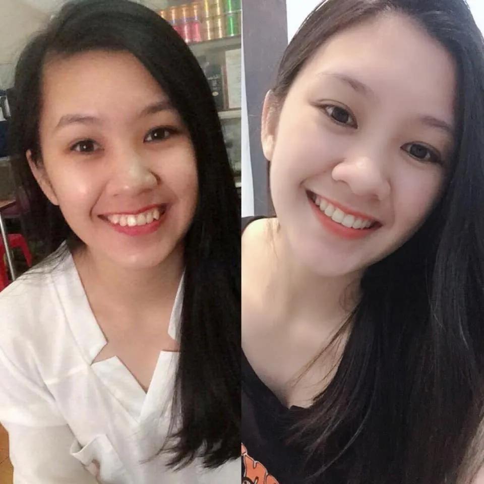 Top 5 địa chỉ niềng răng chất lượng và đáng tin cậy nhất tại Hải Dương