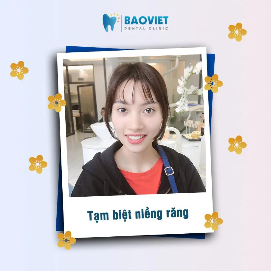 Khám phá 6 địa chỉ niềng răng uy tín, chất lượng hàng đầu tại quận Đống Đa, Hà Nội