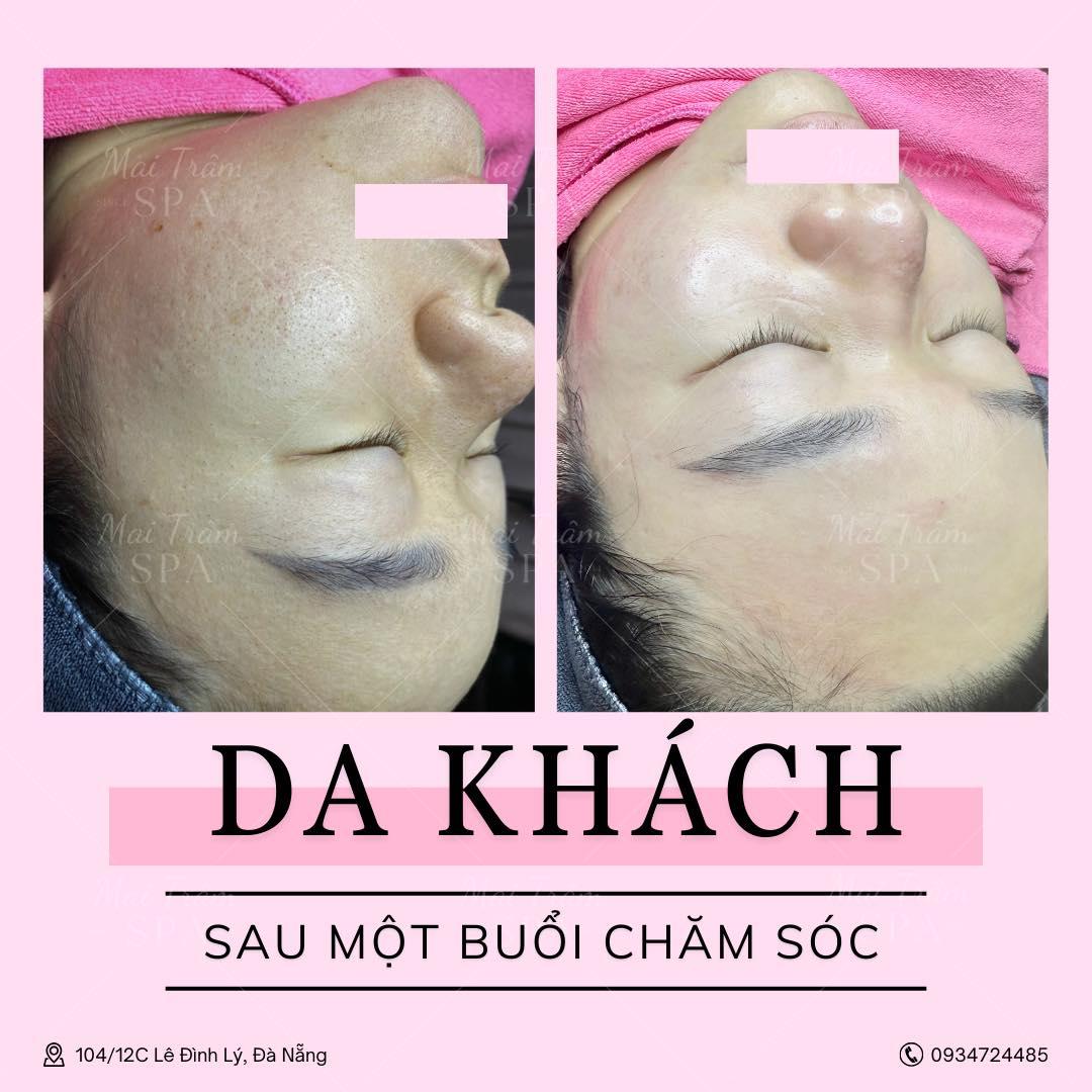 Top 9 Spa làm đẹp uy tín và chất lượng hàng đầu tại Đà Nẵng