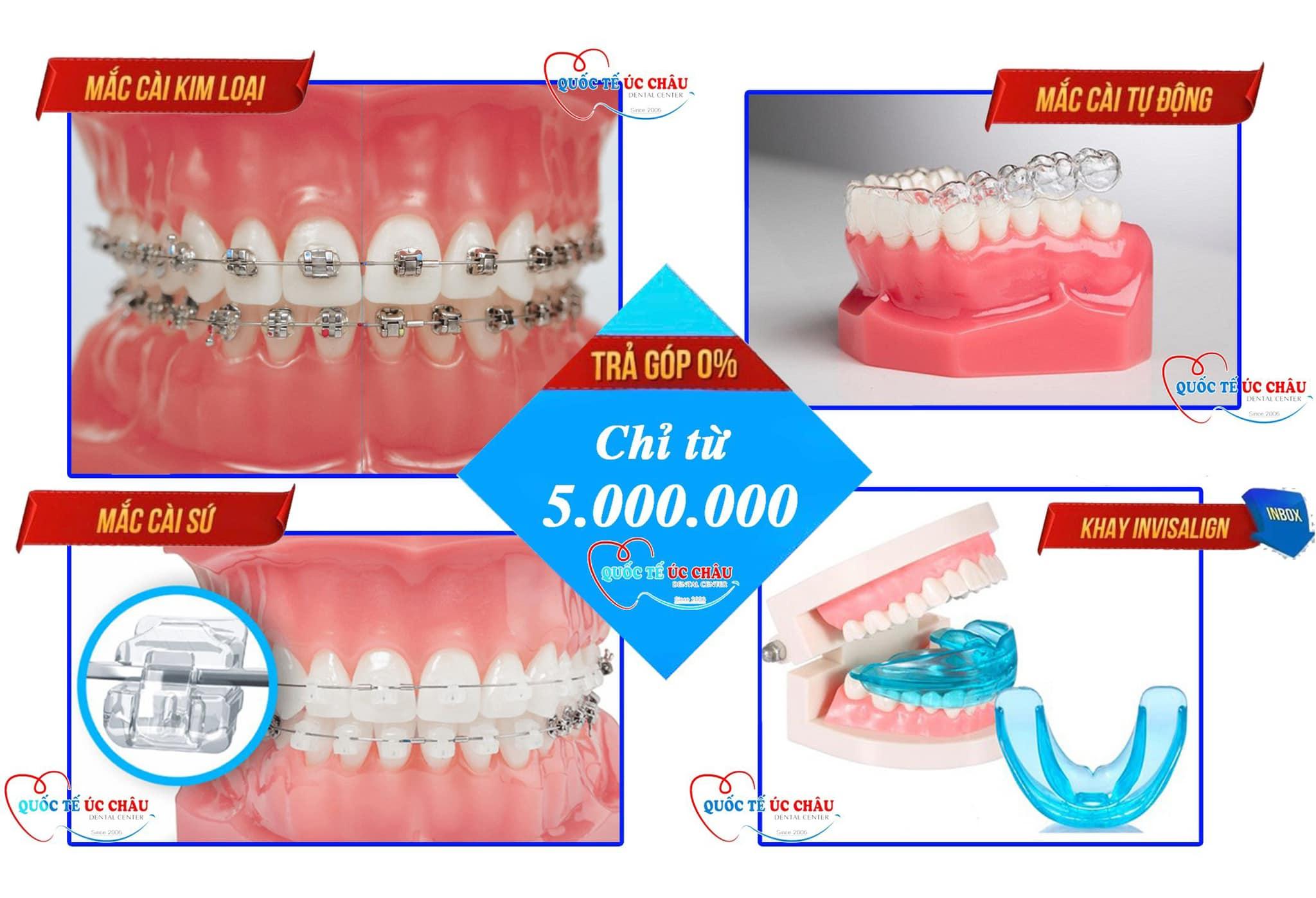 Khám phá 7 địa chỉ niềng răng trả góp uy tín tại Hải Phòng