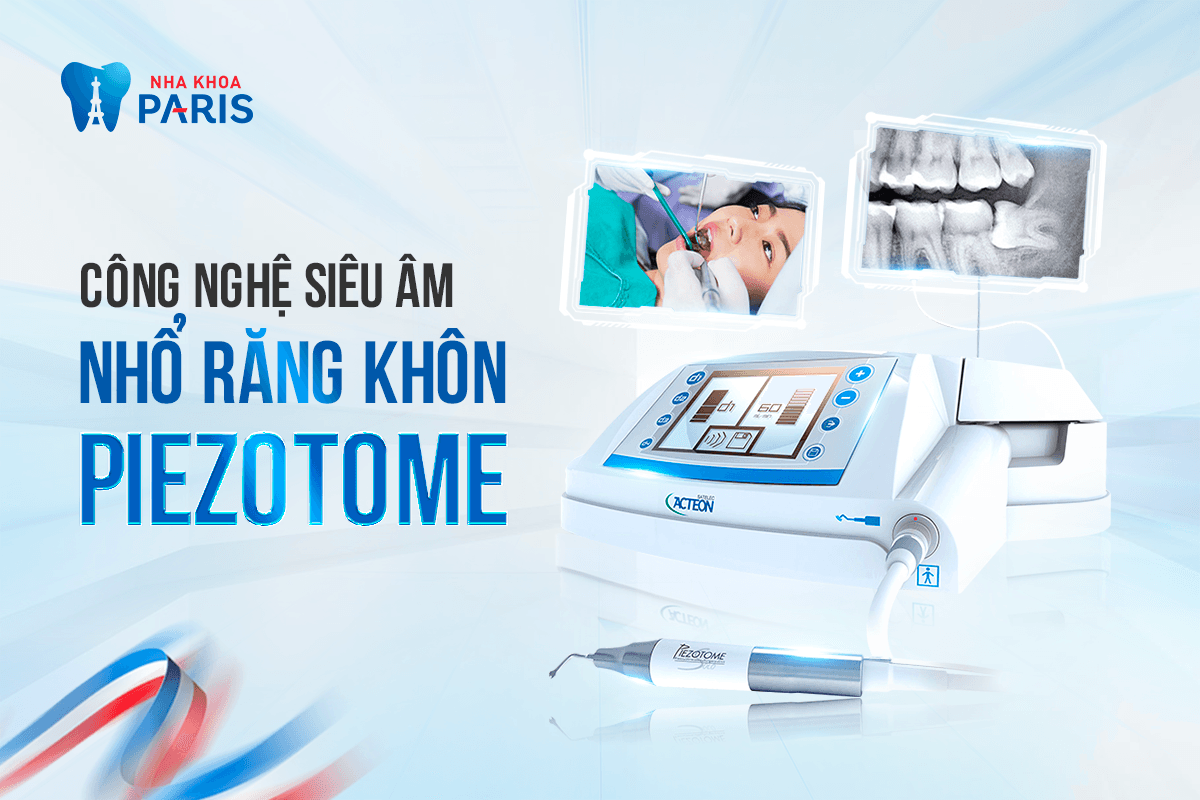 Top 11 địa chỉ nha khoa uy tín chuyên nhổ răng khôn tại Hà Nội