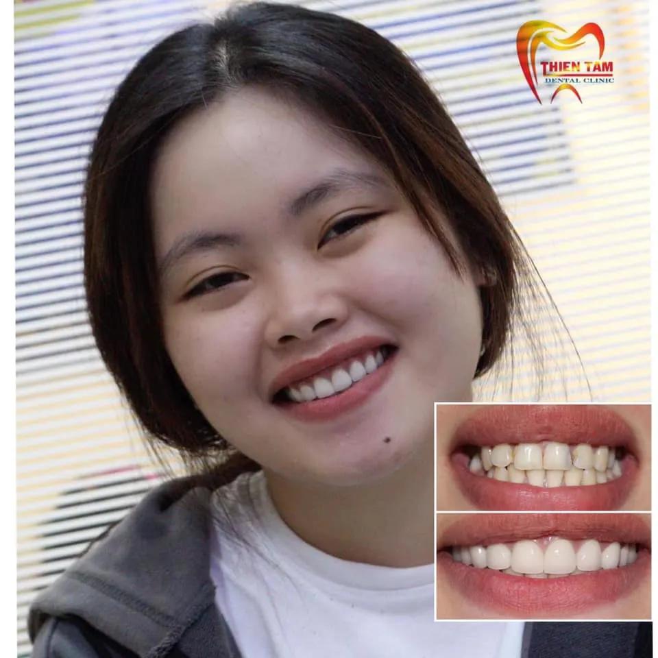 Danh sách 7 phòng khám nha khoa chất lượng và đáng tin cậy nhất tại Long An