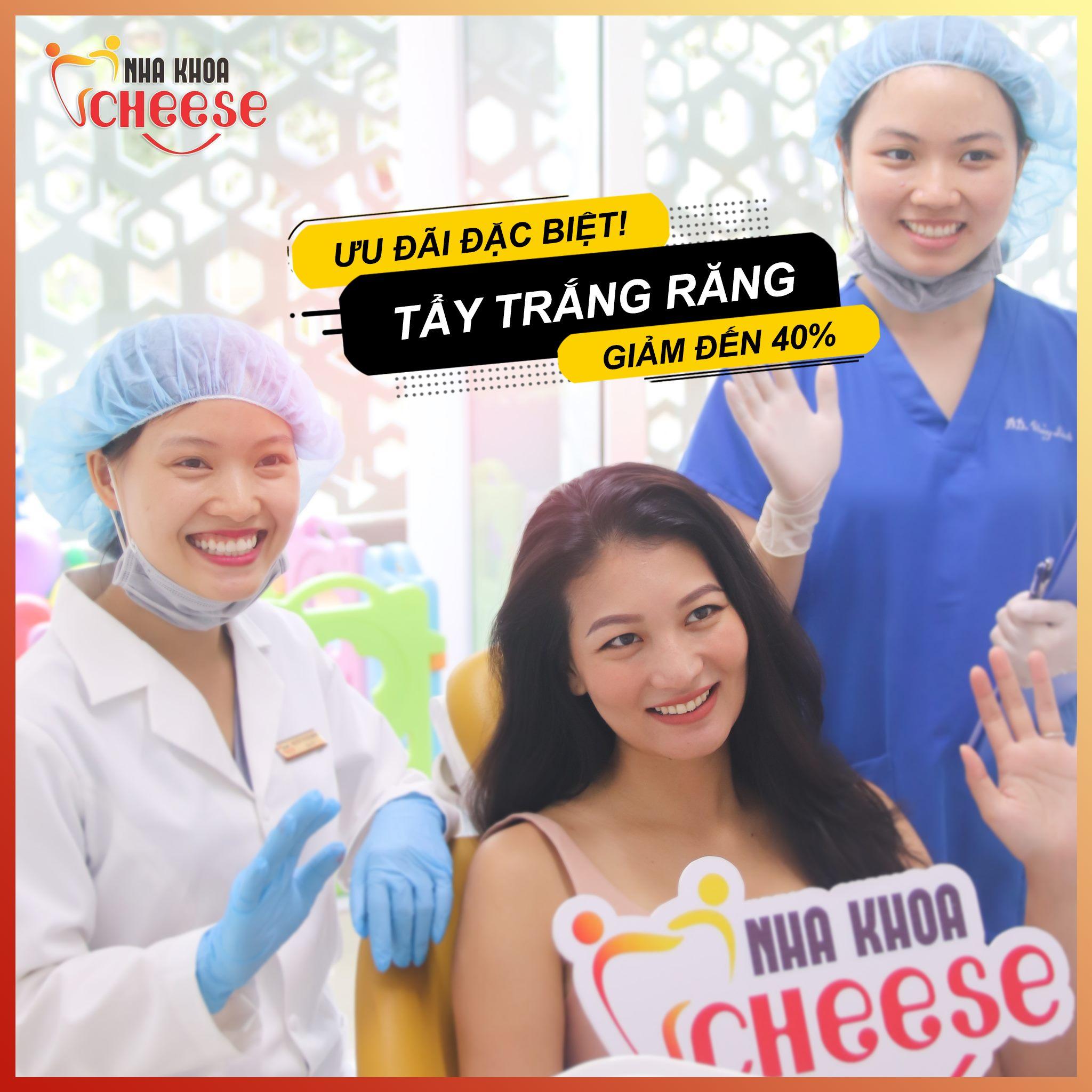 Top 8 địa chỉ tẩy trắng răng uy tín và chất lượng tại Huế